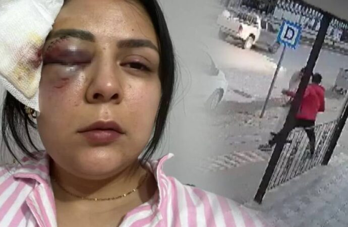Kahramanmaraş’ta kadına yumruk atan kişi tutuklandı