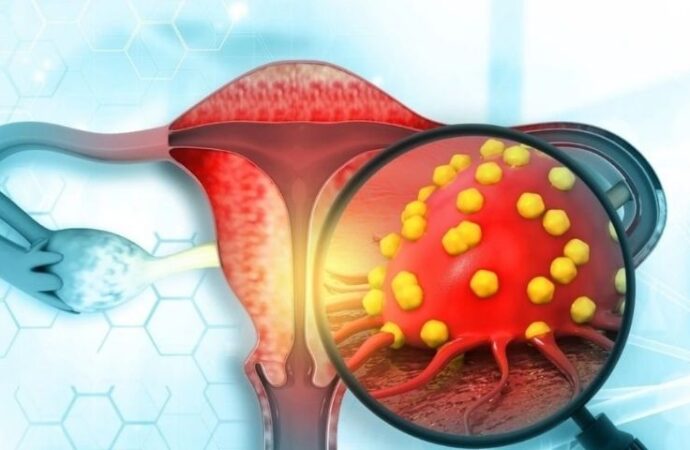 Endometrium Kanseri Sessiz İlerliyor: Uzmanından Kritik Uyarılar